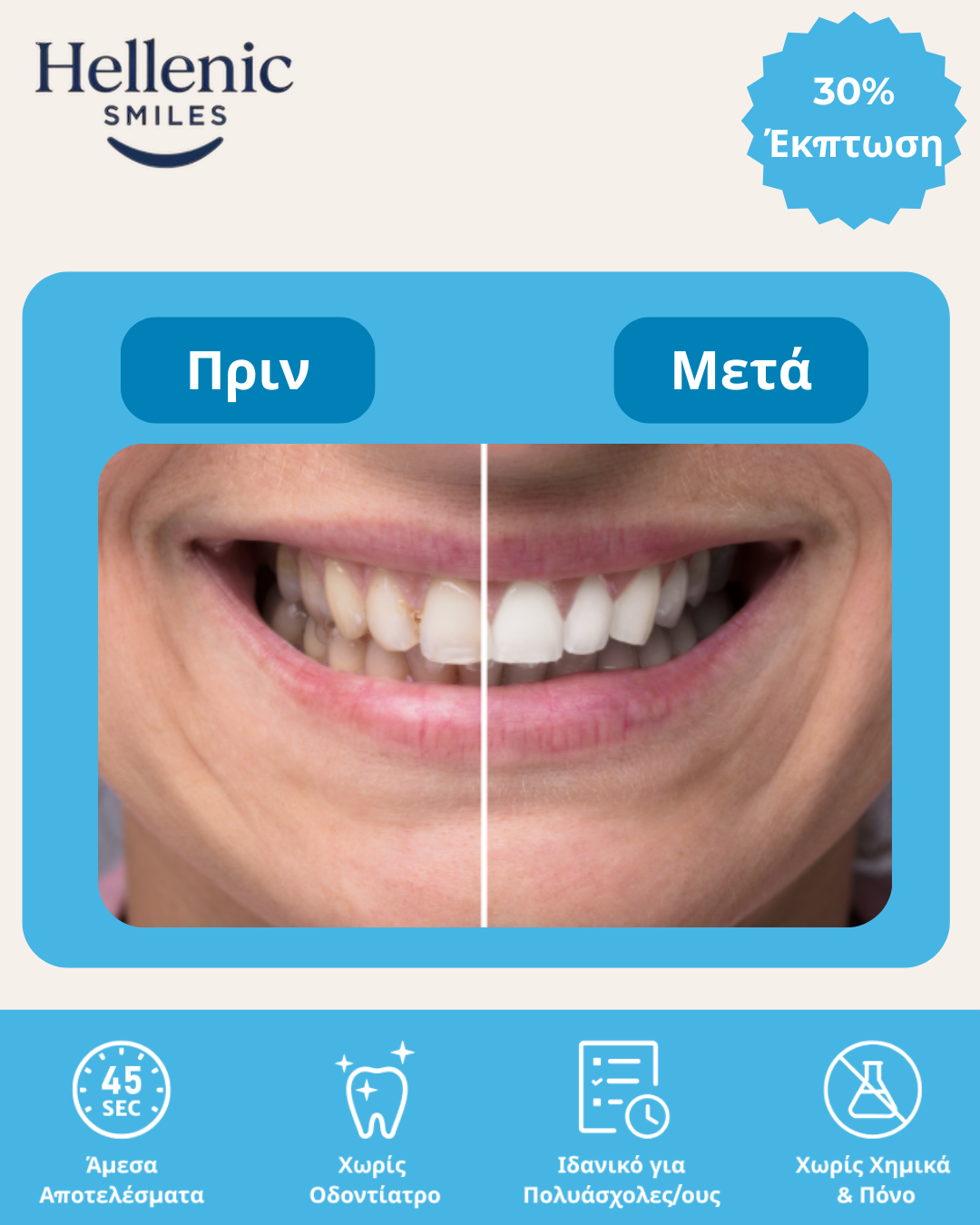 HellenicSmiles : Αυτόματη Οδοντόβουρτσα